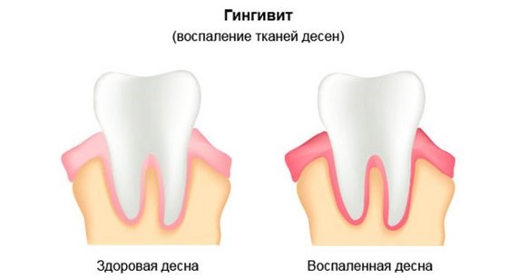 Почему когда болит зуб текут слюни