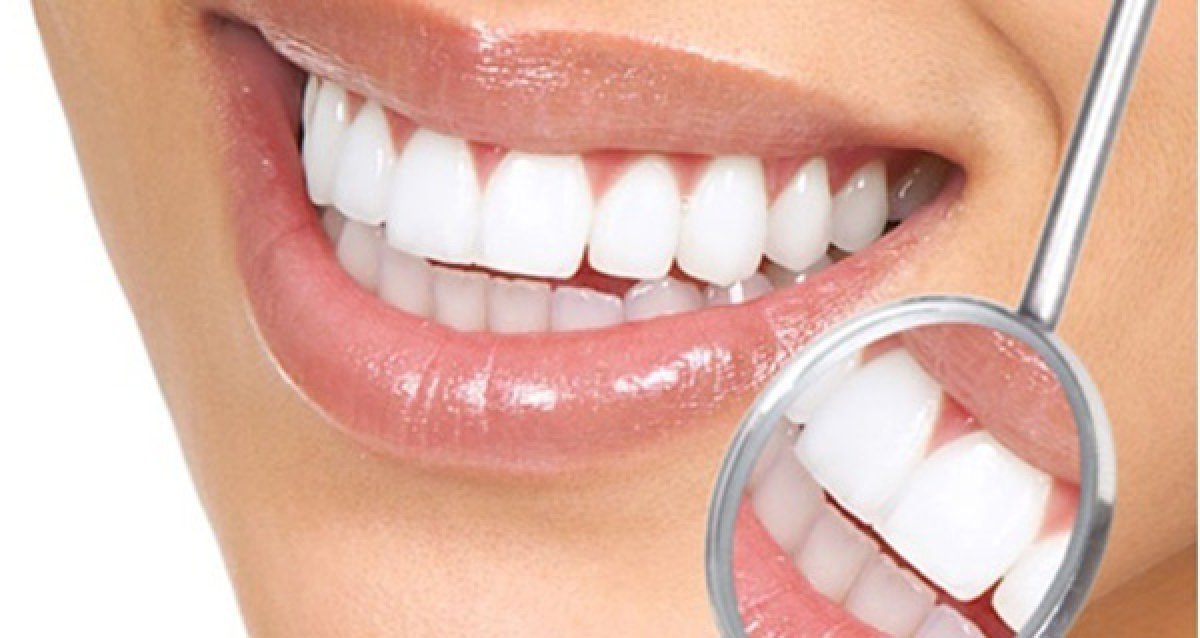 Протезирование зуба коронкой. Металлокерамика и циркон