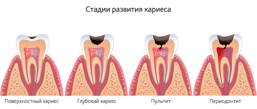 Терапия